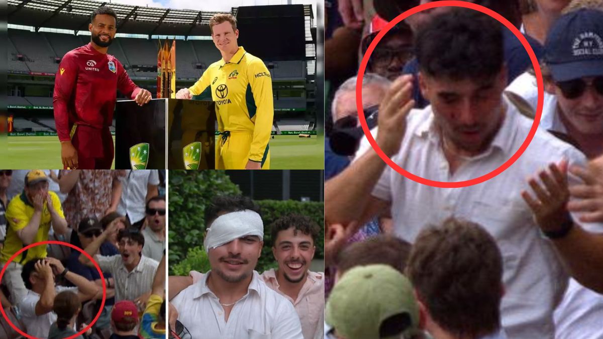Shocking accident during West Indies-Australia ODI, fan's eye torn by ball taken for SIX, becomes blind