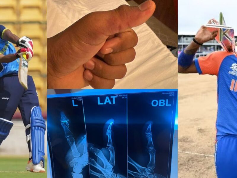 Team India got a second Hardik Pandya from Bengal Pro League, he created havoc with both ball and bat with a broken hand