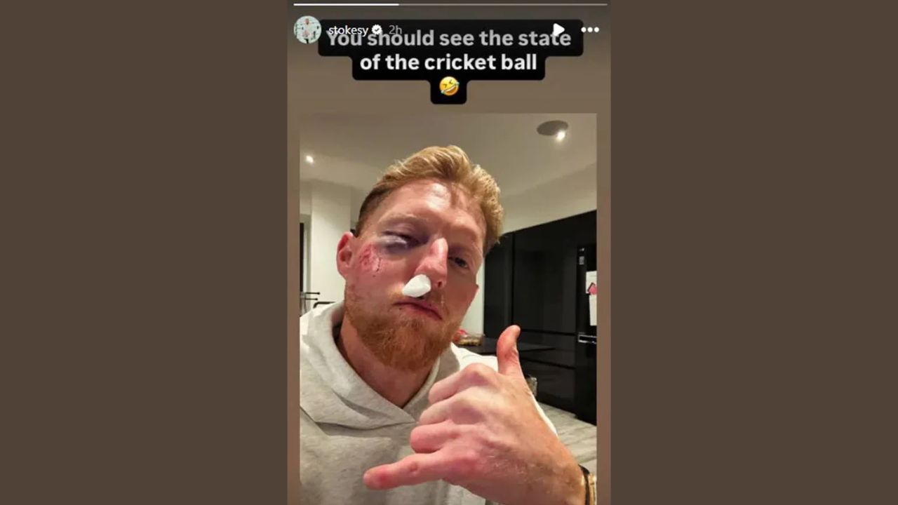 बेन स्टोक्स के साथ अनहोनी! अभ्यास के दौरान गेंद लगने से बिगड़ा चेहरा, नाक-आंख सब हुई बेहाल 2 Ben Stokes के साथ अनहोनी! अभ्यास के दौरान गेंद लगने से बिगड़ा चेहरा, नाक-आंख सब हुई बेहाल